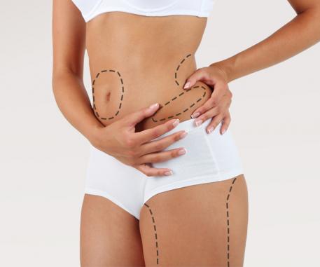 Sleva až 25 % na formování postavy mrazem: zlevnili jsme pro vás Cooltech