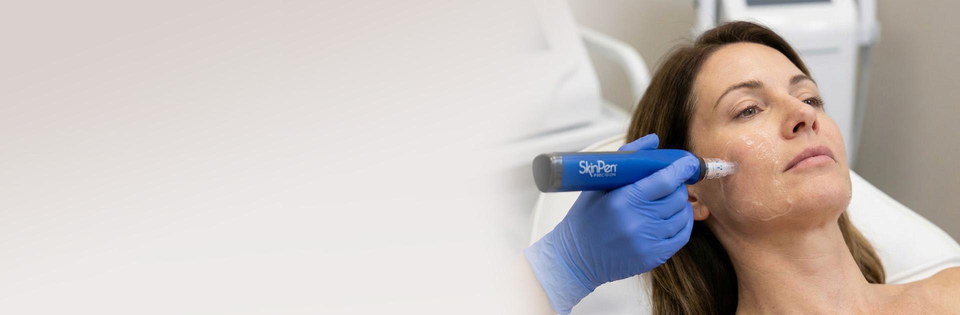 Microneedling der Haut