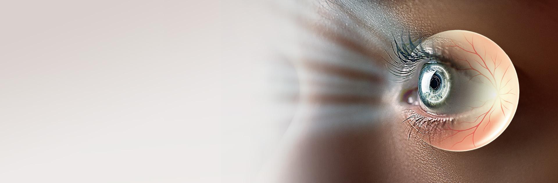 AI-Screening des Augenhintergrunds zur Früherkennung schwerer Erkrankungen